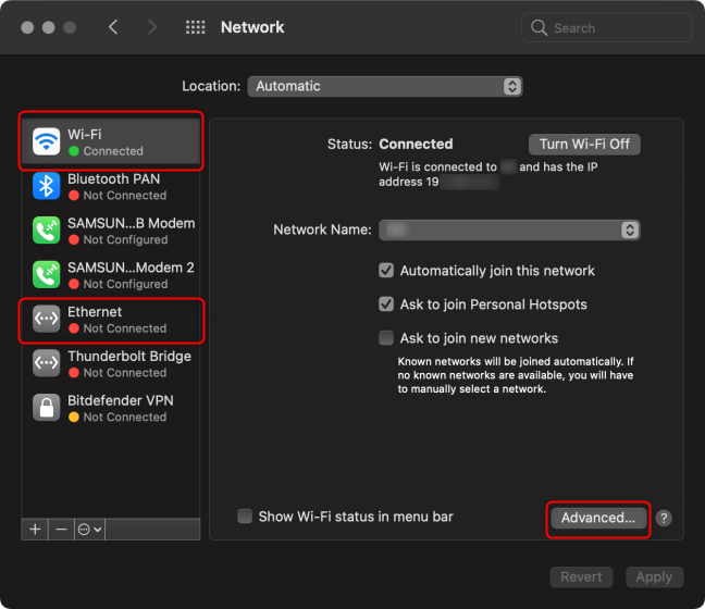 Select your network connection and press Advanced