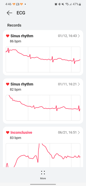 Do you need a history of your ECG records?