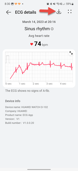 Download an ECG to share it with your doctor