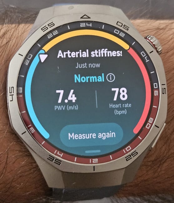 HUAWEI WATCH GT 5 Pro can evaluate your arterial stiffness