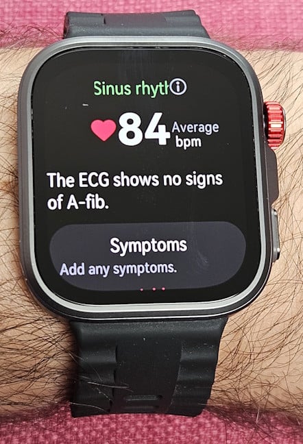 Recording an ECG is easy