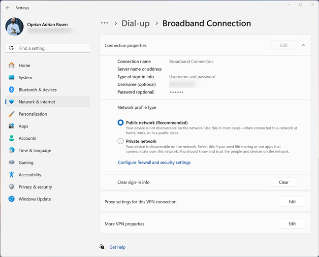 Your PPPoE connection settings